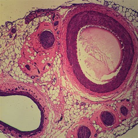 Mammal Artery Vein And Nerve Cs 7 µm Hematoxylin And Eosin Microscope Slide