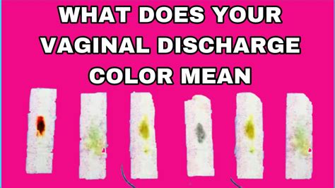 What Does Your Vaginal Discharge Colour Mean Yeastinfection