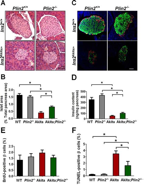 Ablation Of Plin2 Partially Rescues β Cell Mass In Akita Mice A
