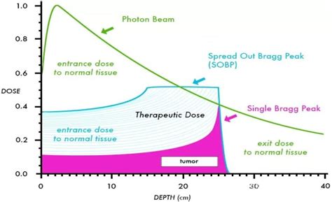 Proton Therapy Is The First Choice For Head And Neck Tumors