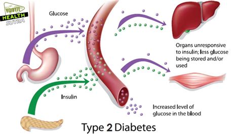 Abnormalities in Type 2 Diabetes symptoms and Type 1 Diabetes | All To ...