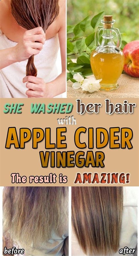 She Washed Her Hair With Apple Cider Vinegar The Result Is Amazing