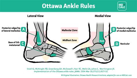 Rock Climbing Injury Ankle Sprain Rehab The Climbing Doctor