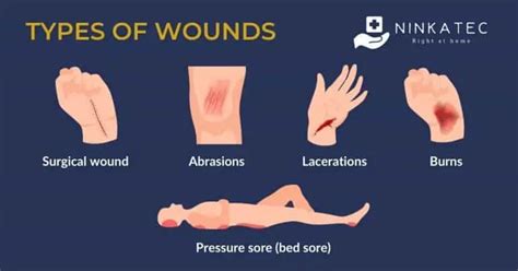 Caring For A Wound At Home A Caregivers Guide Ninkatec
