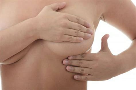 Breast Cellulitis Causes Treatment Symptoms And More My Xxx Hot Girl