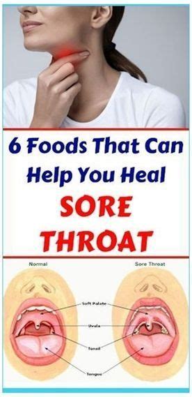 How To Get Rid Of Tonsillitis And Sore Throat In Only Few Hours Heal