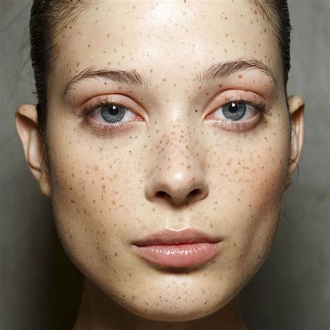 Freckles Are The New It Beauty Mark Freckles