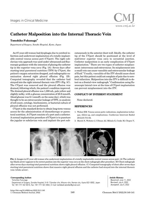 Pdf Catheter Malposition Into The Internal Thoracic Vein