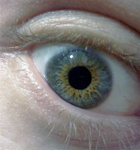 My Central Heterochromia Eyes Eyes