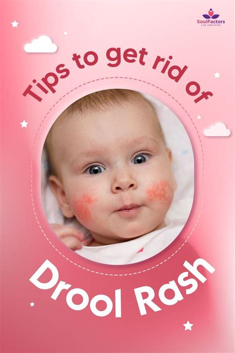 Tips To Get Rid Of Drool Rash In 2022 Drooling Baby Baby Rash Baby