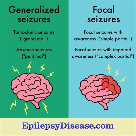 What Are The Types Of Seizures With Epilepsy