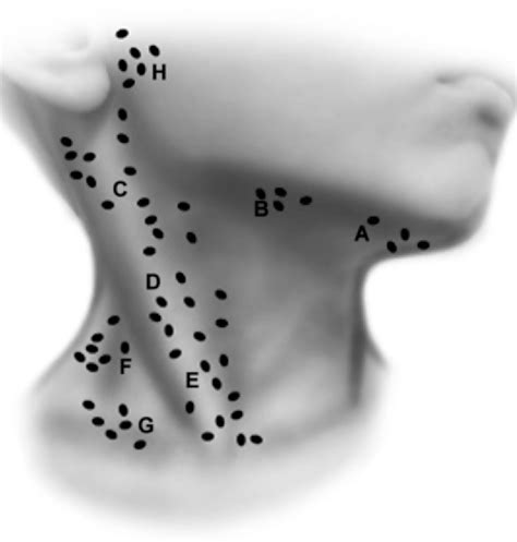 Figure 1 From Pediatric Cervical Lymphadenopathy Semantic Scholar