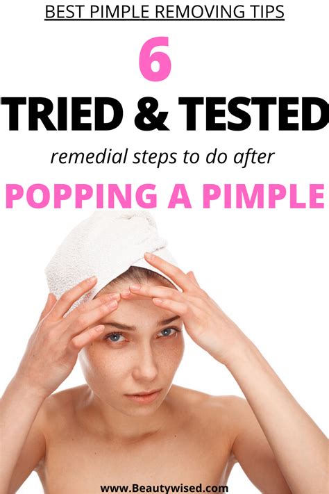 Best Pimple Popping Tips Like How To Properly Pop A Pimple And How To