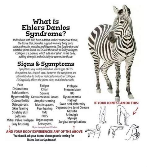 Ehlers Danlos Syndrome Treatments Hubpages