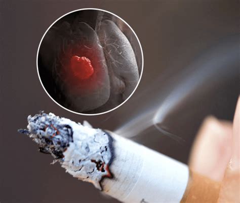 unraveling science mystery of how smoking causes lung cancer it s the basal stem cells