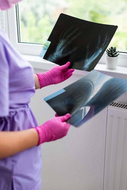 Premium Photo Doctors Hands Holding At Xray Radiography Images At