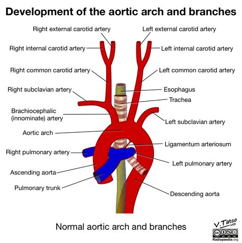 Branches If The Aortic Arch Arteries Anatomy Medical Anatomy Human My