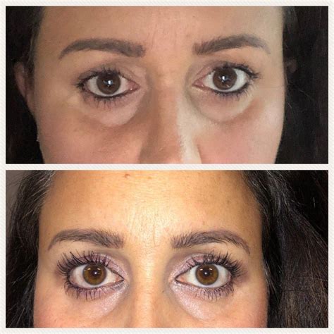 Lash lift and tint can make your eyes more beautiful and bold. Do it yourself lash lift at home. (With images) | Lash ...