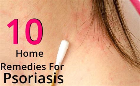 11 Best Psoriasis Anatomy Images On Pinterest Health Psoriasis