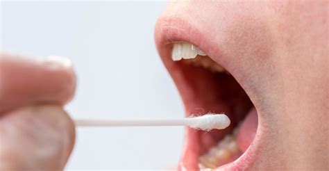 Nowotwory Jamy Ustnej Przyczyny Objawy I Leczenie