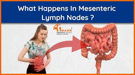 Mesenteric Lymph Nodes Mesenteric Lymph Nodes Treatment In Homeopathy