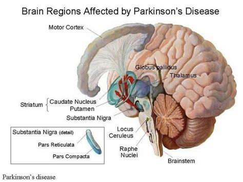 Neurology Neuroanatomy Brain Areas Affected By Parkinsons Disease Pd Homöopathie