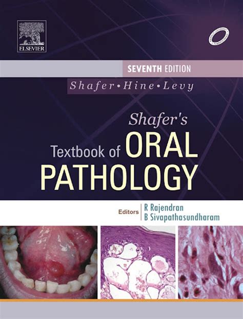 Shafers Textbook Of Oral Pathology 7th Edition Pdf Free Download
