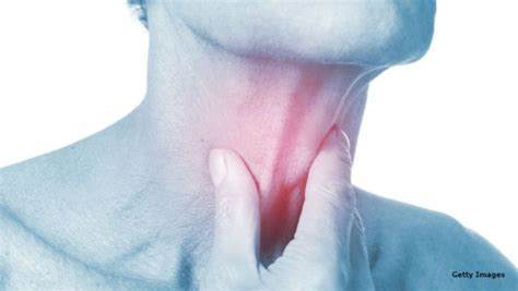 Sore Throat Pharyngitis Overview Causes Symptoms And Treatment