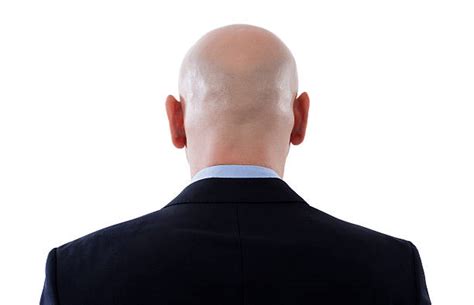 Completely Bald Shaved Head Balding Men Stock Photos Pictures