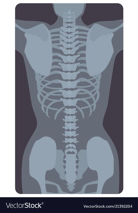 Anterior Radiograph Of Human Rib Cage And Pelvis Vector Image