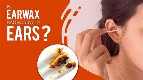 Is Earwax Bad For Your Ears Youtube
