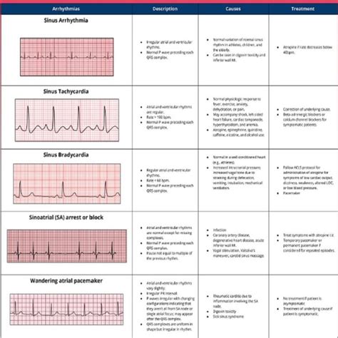 Basic EKG Interpretation 3 Pages Long Printable Pdf Etsy Ekg