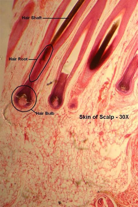 G Scalp 30x 6 Hair Follicle Regions