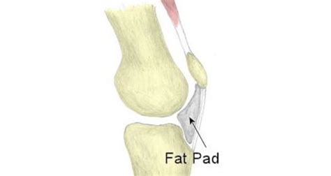 Knee Fat Pad Anatomy
