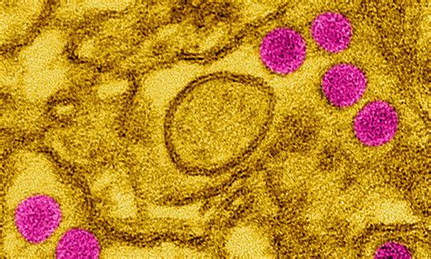 Zika Virus Successfully Produced In The Laboratory Max Planck