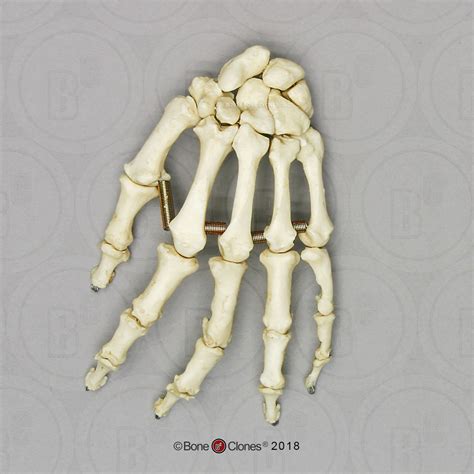 Human Female Achondroplasia Dwarf Hand Articulated Premium Flexible