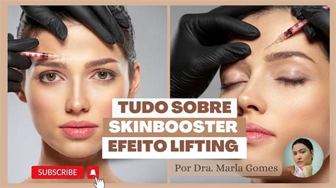 Tudo Sobre Skinbooster Efeito Lifting Da Phd Do Brasil Youtube