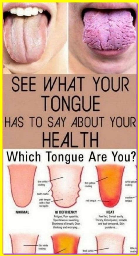 what does your tongue say about your health
