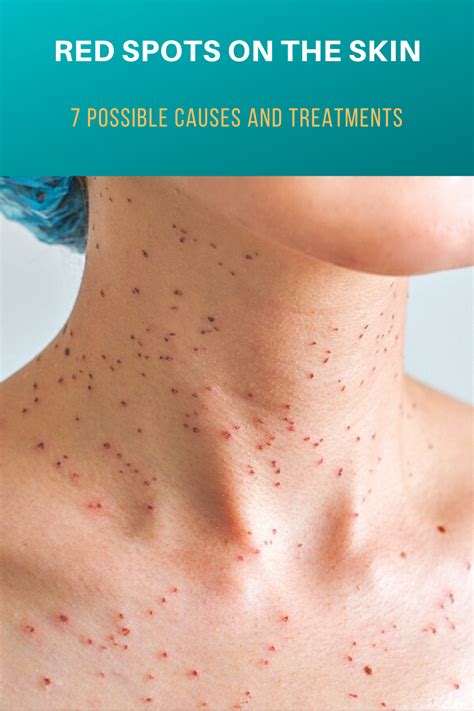 Red Spots On The Skin 7 Possible Causes And Treatments