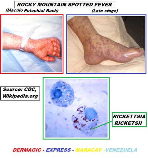 Dermagic Express Dermatologia Y Bibliografia Dermatology