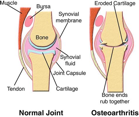 If you're unsure what one is, look through our list and learn about how they help with our daily lives. bones with ligaments tendons and cartilage - Google Search ...