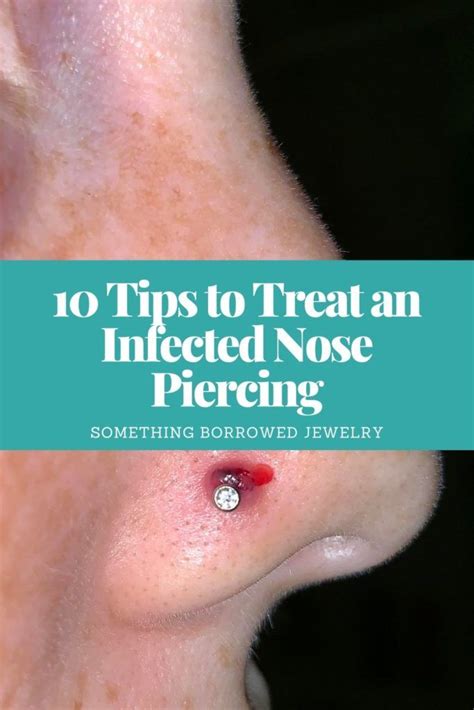 10 Tips To Treat An Infected Nose Piercing Cleaning Nose Piercing Nose Piercing Tips Two Nose