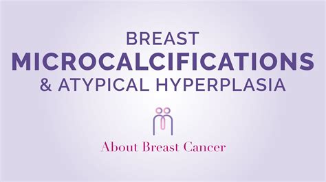 Breast Microcalcifications And Atypical Hyperplasia Youtube