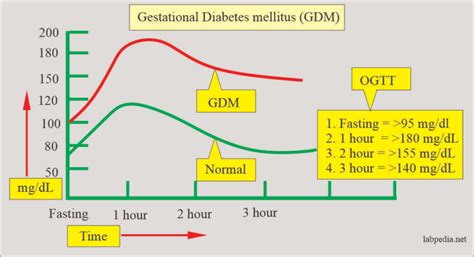 Curva Glicemica Da Carico Ogtt Oral Glucose Tolerance Test