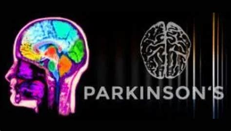 Parkinsons Sleep Wake Cycle Science Of Light