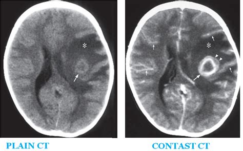 Doctors Network Ct Scan Of Head