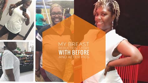 My Breast Reduction Story Treasuremaricia Youtube