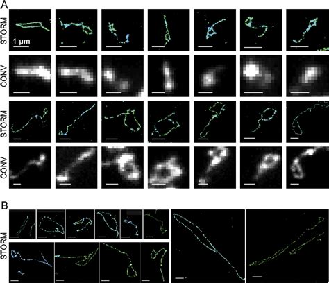 Super Resolution Fluorescence Imaging Of Telomeres Reveals Trf2