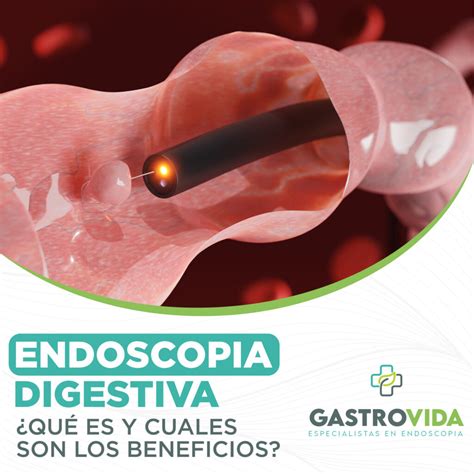 Qué es la Endoscopia Digestiva y cuáles son sus Beneficios