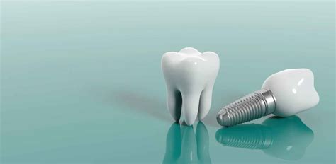 Dental Implants Vs Crowns Which One Is Right For You